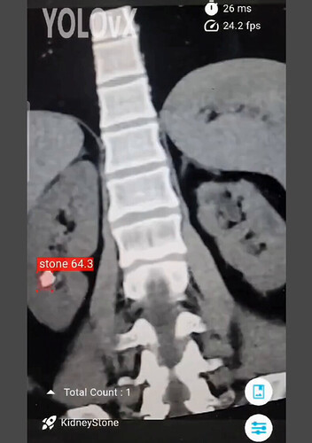 Screenshot from WhatsApp Video 2024-12-24 at 16.59.35.mp4